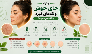 چگونه جای جوش و لک‌های تیره را کاهش دهیم؟ راهنمای علمی و کامل